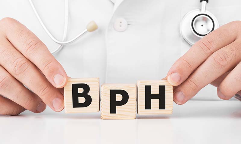 what-is-BPH_-causes-symptoms-and-treatment
